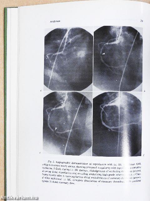 Critical Care Cardiology