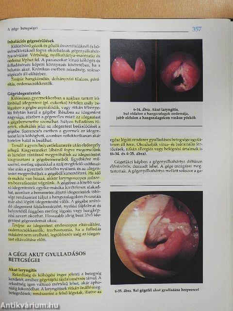 Fül-orr-gégészet, fej-nyak sebészet