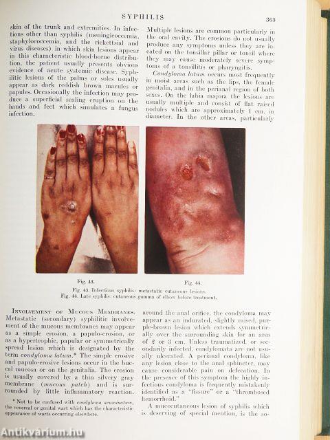 A Textbook of Medicine