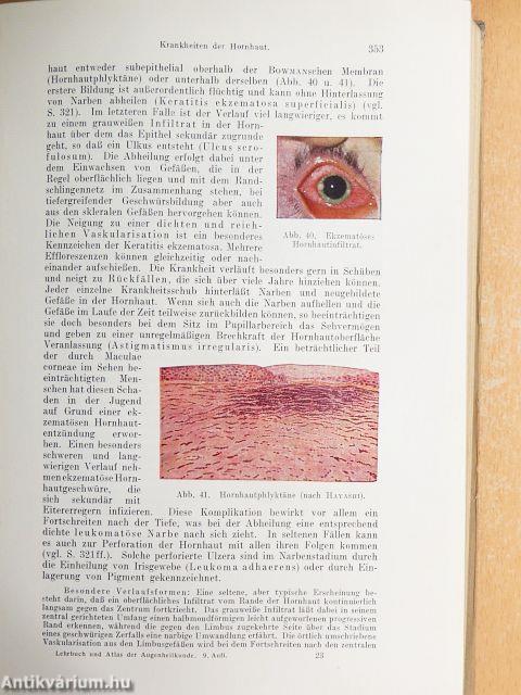 Lehrbuch und Atlas der Augenheilkunde