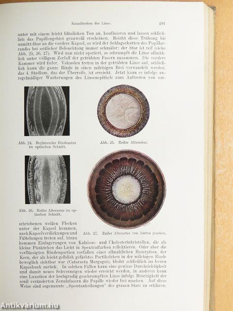 Lehrbuch und Atlas der Augenheilkunde