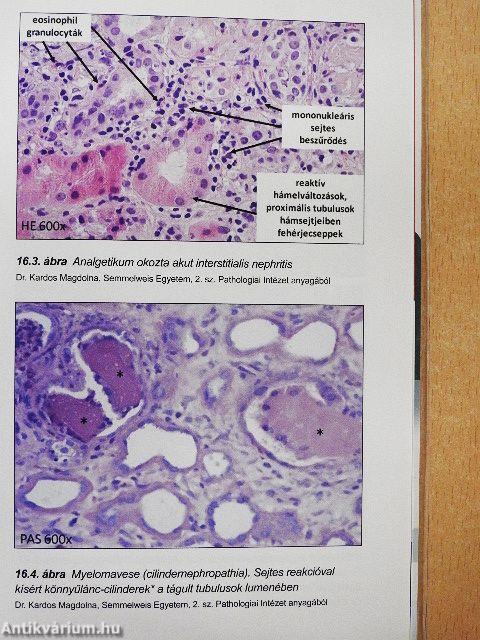 Hypertonia és nephrologia a háziorvosi gyakorlatban