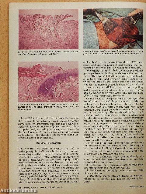 JAMA April 1, 1974