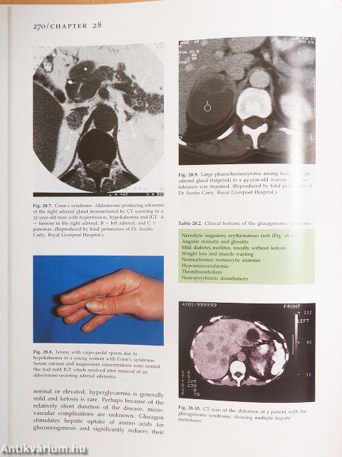 Textbook of Diabetes I.