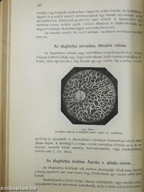 A szemészet tankönyve