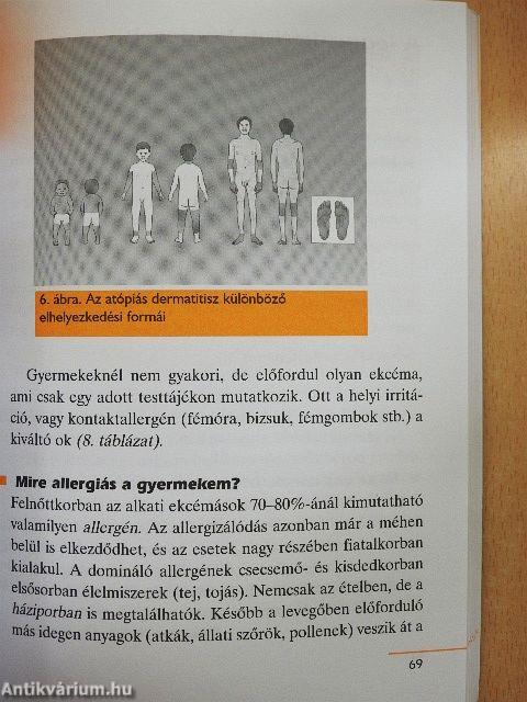 Gyermekkori allergiák