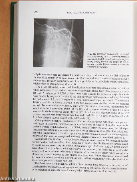 Cardiovascular Drugs and the Management of Heart Disease