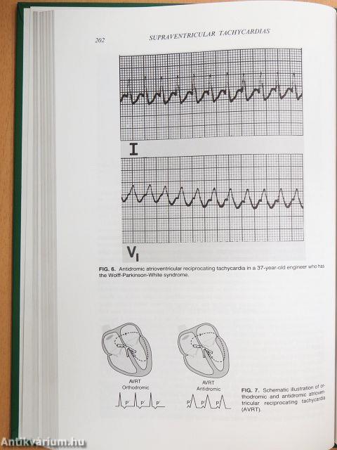 Cardiovascular Drugs and the Management of Heart Disease