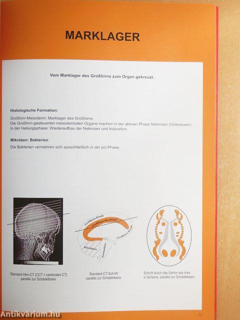 Wissenschaftliche Tabelle der Germanischen Neuen Medizin