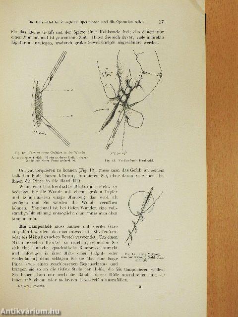 Technik dringlicher Operationen