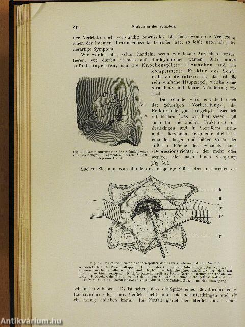 Technik dringlicher Operationen