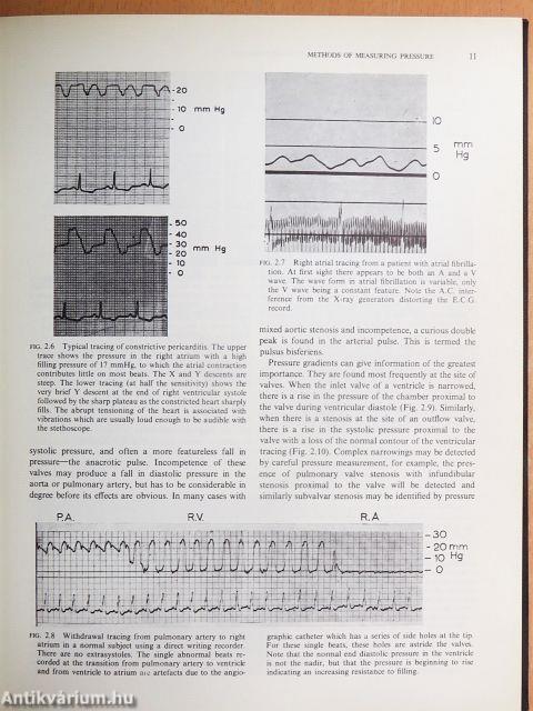 Cardiac Catheterization and Angiocardiography