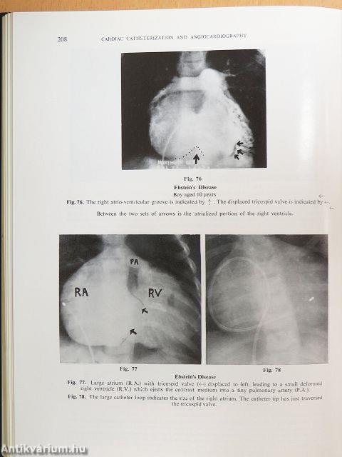 Cardiac Catheterization and Angiocardiography