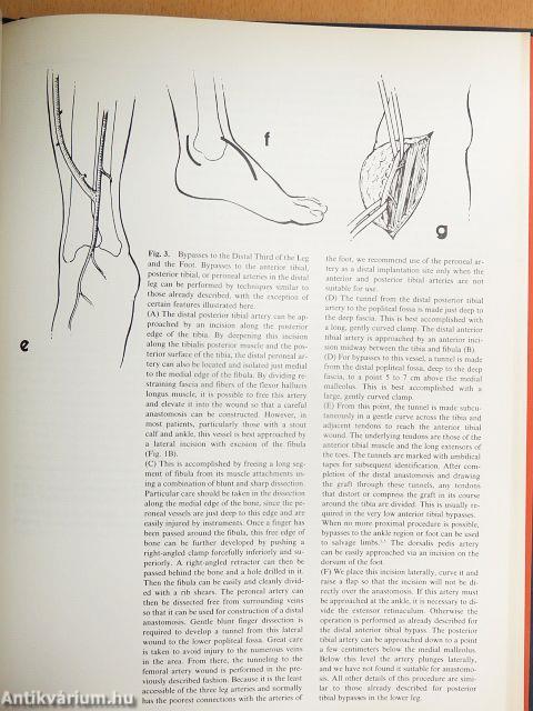 Operative Techniques in Vascular Surgery