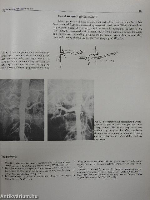 Operative Techniques in Vascular Surgery