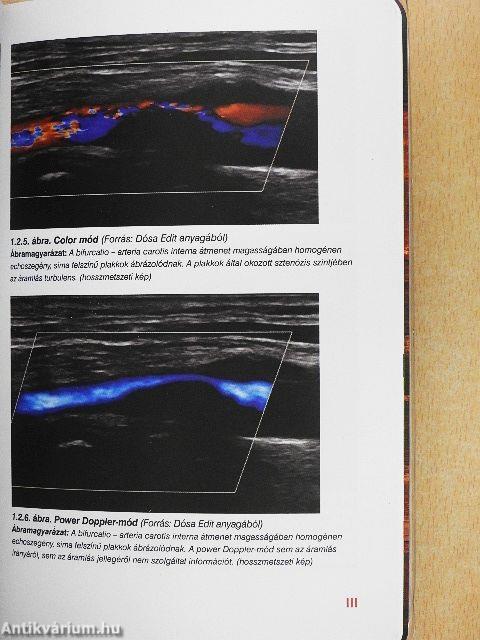 Angiológia a háziorvosi gyakorlatban