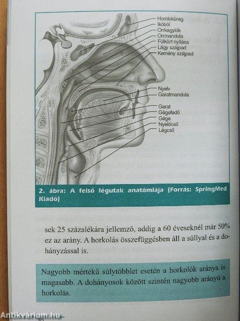 Horkolás, légzéskimaradás-alvási apnoe?
