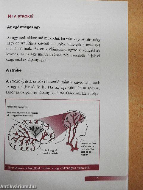 Hogyan kerüljük el a szívrohamot és a szélütést?