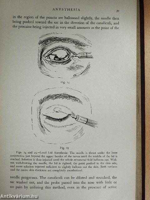 Surgery of the Eye