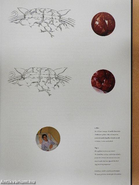 Művészet és idegsebészet együtt a hitben