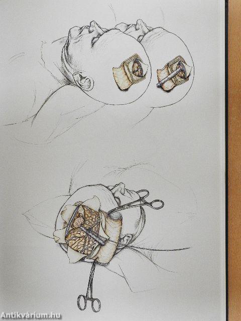 Művészet és idegsebészet együtt a hitben