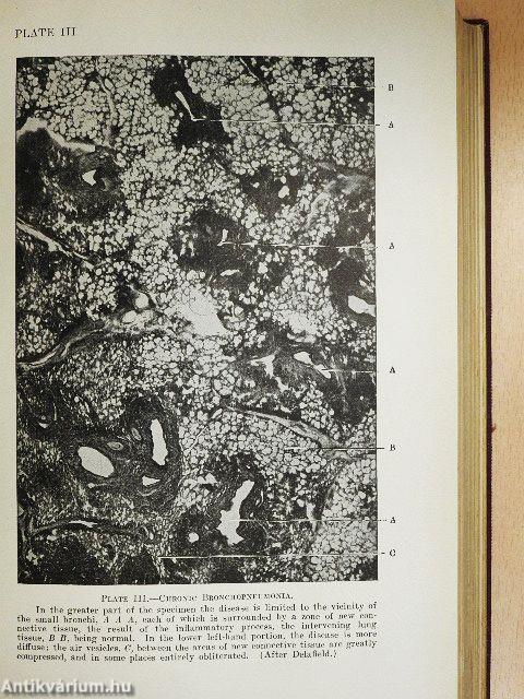 The Diseases of Infancy and Childhood