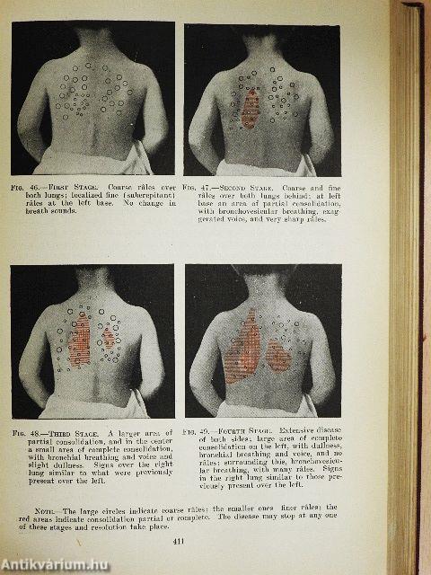 The Diseases of Infancy and Childhood