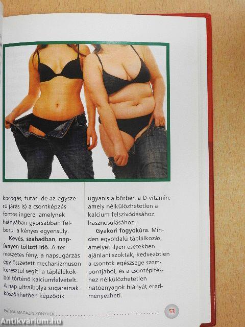A csontritkulásról