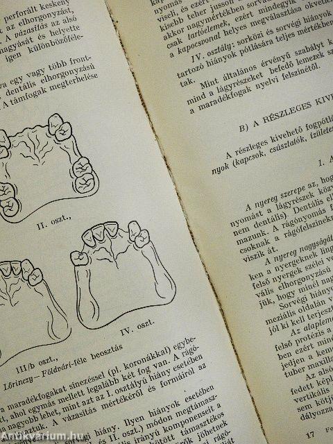 A fogpótlás technológiája