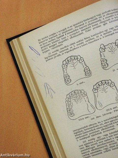 A fogpótlás technológiája