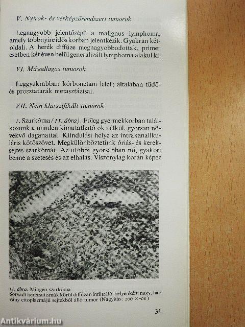 A férfi nemi szervek daganatos megbetegedései