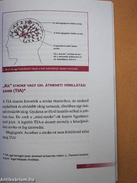 Hogyan kerüljük el a szívrohamot és a szélütést?