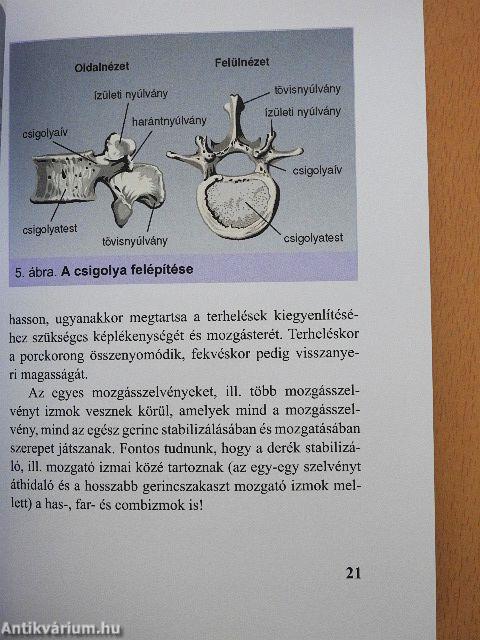 Derékfájás, isiász