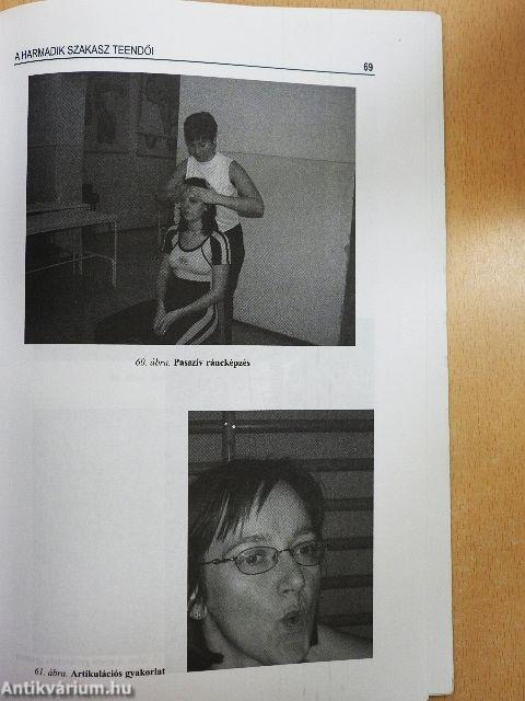 A stroke betegek rehabilitációja