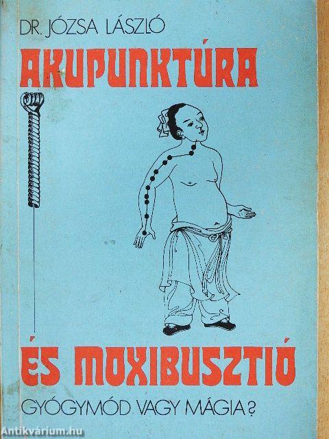 Akupunktúra és moxibusztió