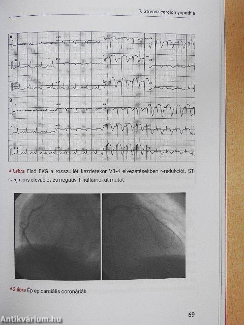 SpringMed Orvosi esettanulmányok - Kardiológia