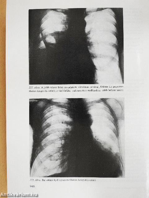 A belgyógyászat alapvonalai 1-2.