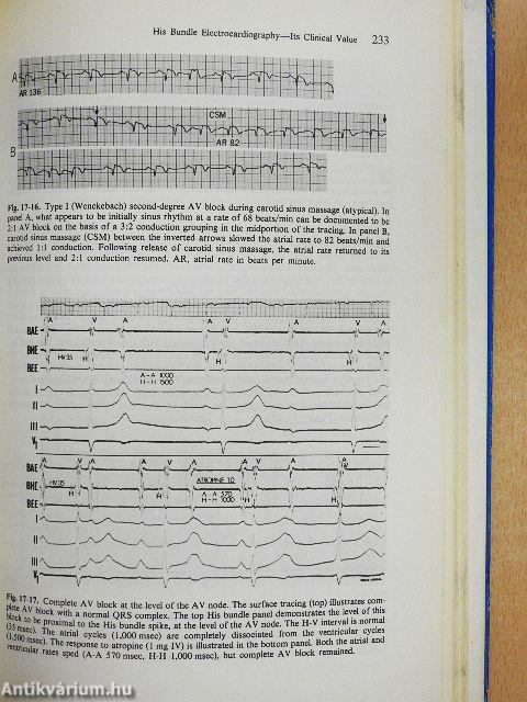 Controversy in Cardiology