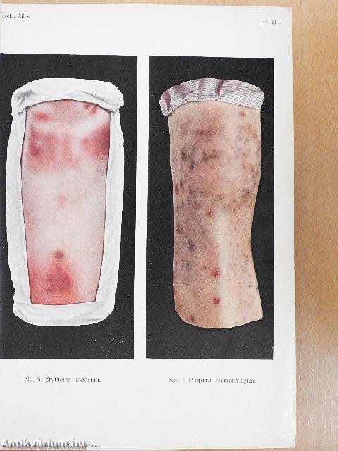 Atlas der Hautkrankheiten