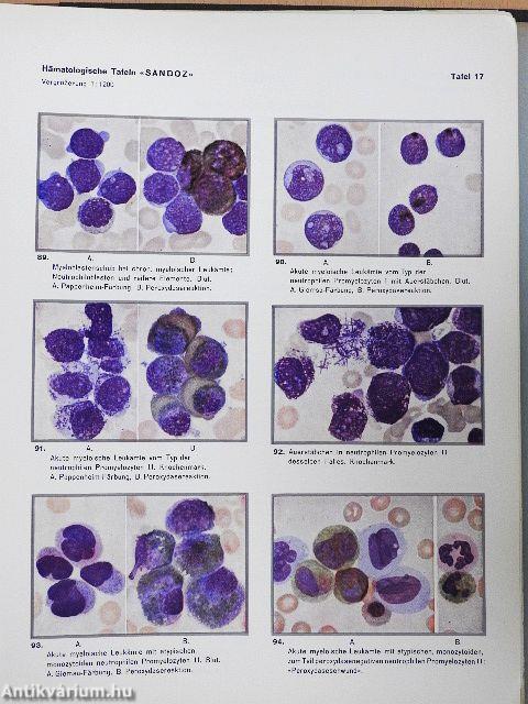 Hämatologische Tafeln Sandoz