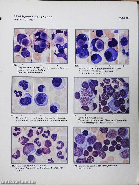 Hämatologische Tafeln Sandoz