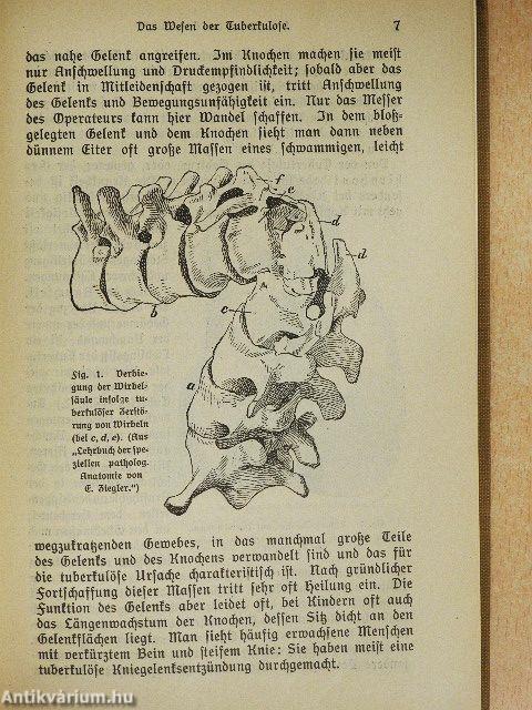 Die Tuberkulose (gótbetűs)