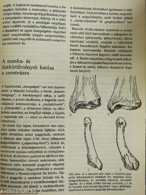 Sírok, csontok, emberek