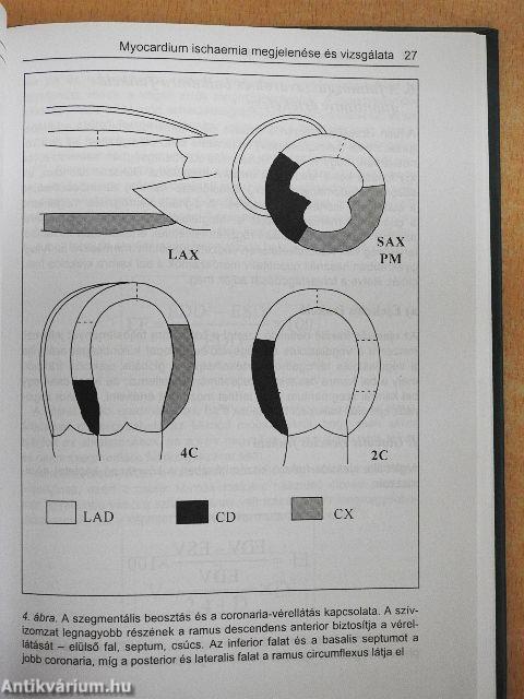 Terheléses echocardiographia