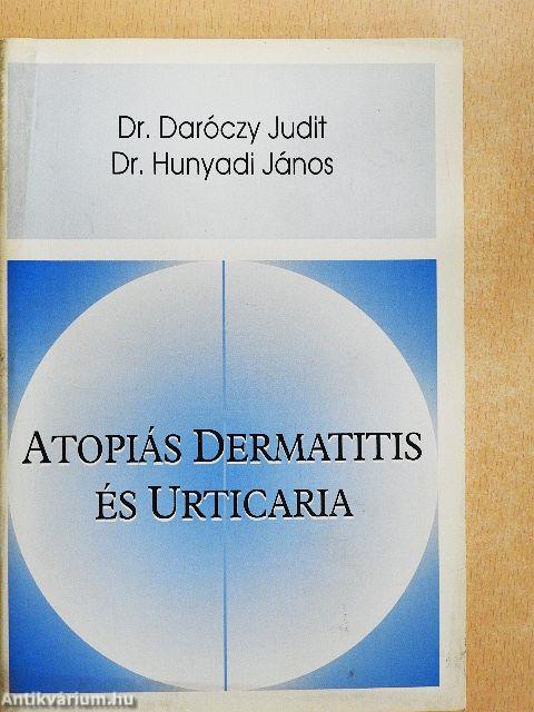 Atopiás dermatitis és urticaria