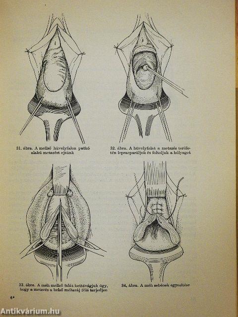 Nőgyógyászati műtéttan