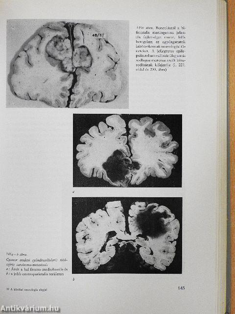 A klinikai neurologia alapjai