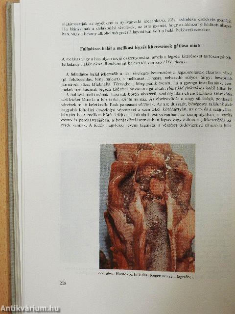 Az igazságügyi orvostan alapjai