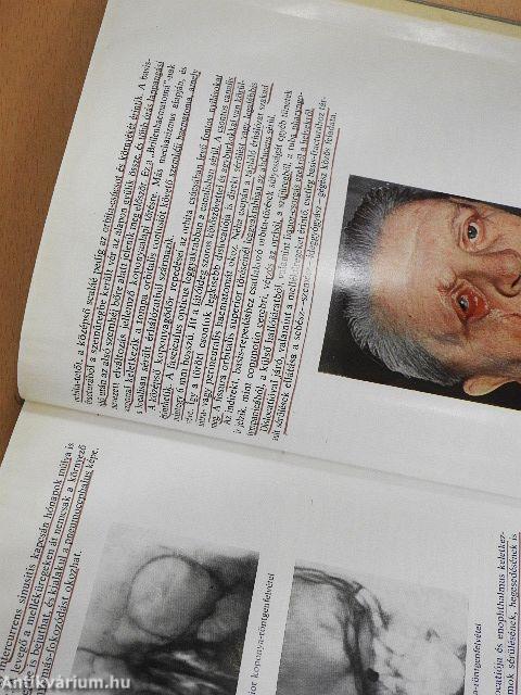 A szemészet alapvonalai