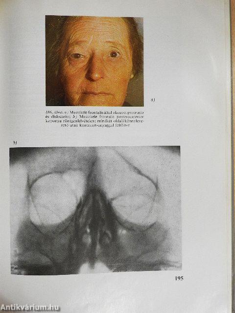 A szemészet alapvonalai